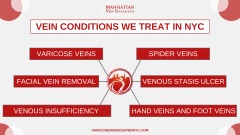 Varicose Vein Treatments Center